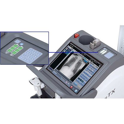 Dynamic Digital Radiography