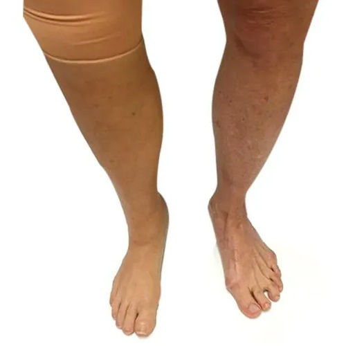 Cosmetic Restoration Silicone Leg - Attributes: Soft & Comfortable