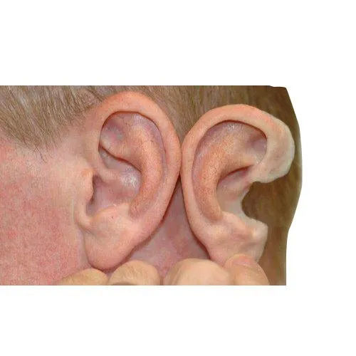 Cosmetic Restoration Ear - Attributes: Skin Friendly