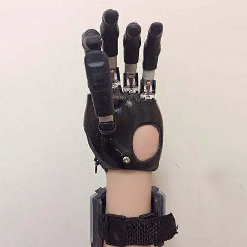 I Limb Bionic Hand