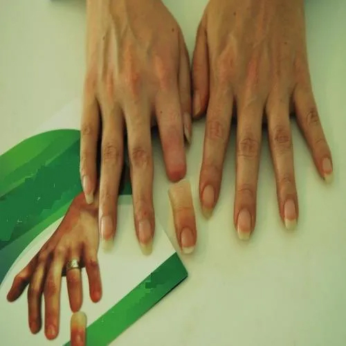 Artificial Silicone Finger - Durable High-Quality Silicone Material, Customizable Skin-Colored Design for Enhanced Surgical Precision