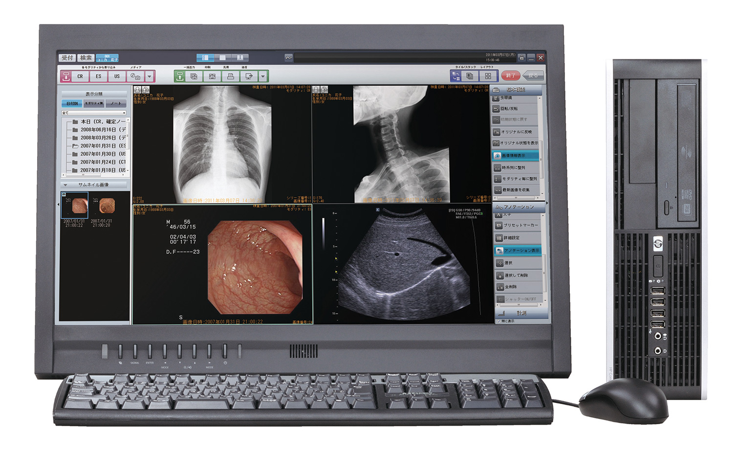 Konica CR System for Digital Radiography