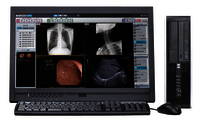 Konica CR System for Digital Radiography