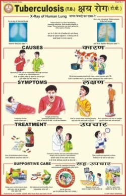 प्राकृतिक रंग क्षय रोग चार्ट