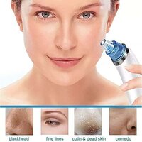 2 in 1 Blackhead Whitehead Extractor Remover Devices