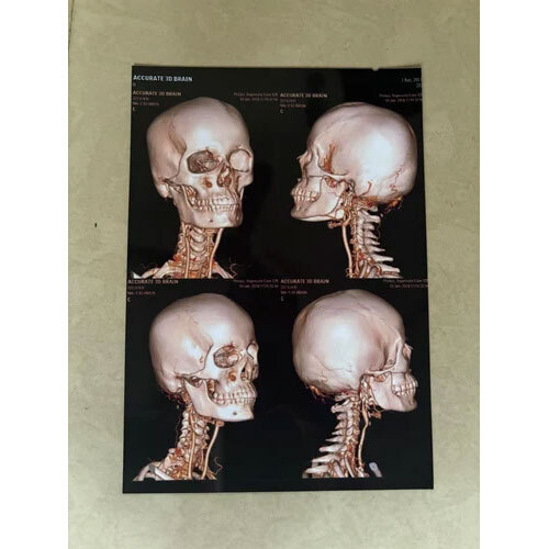 PVC WHITE MEDICAL FILMS A4. For CT-MRI (color)