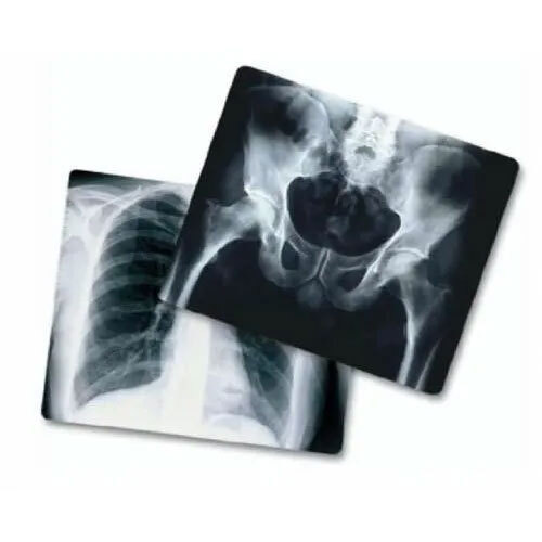 Digital X Ray Films