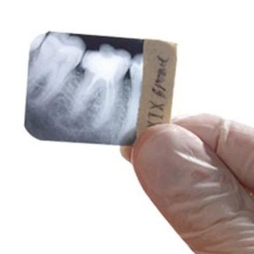 Dental X Ray Film - Color: White