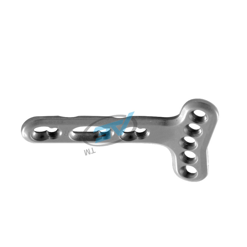 2.7mm Locking  Articular Distal Radius plate           