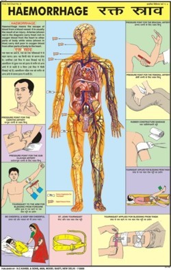हेमोरेज चार्ट आयाम: 50 A 75 सेंटीमीटर (Cm)