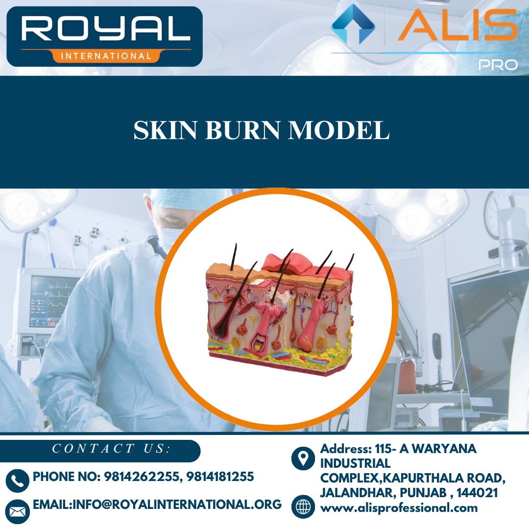 Skin Burn Model