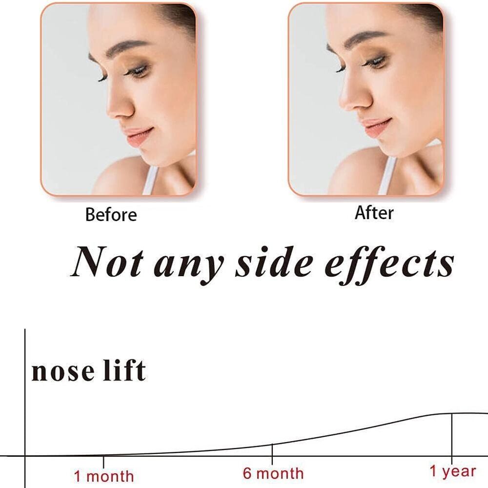 Silicone Nose Shaper Clip