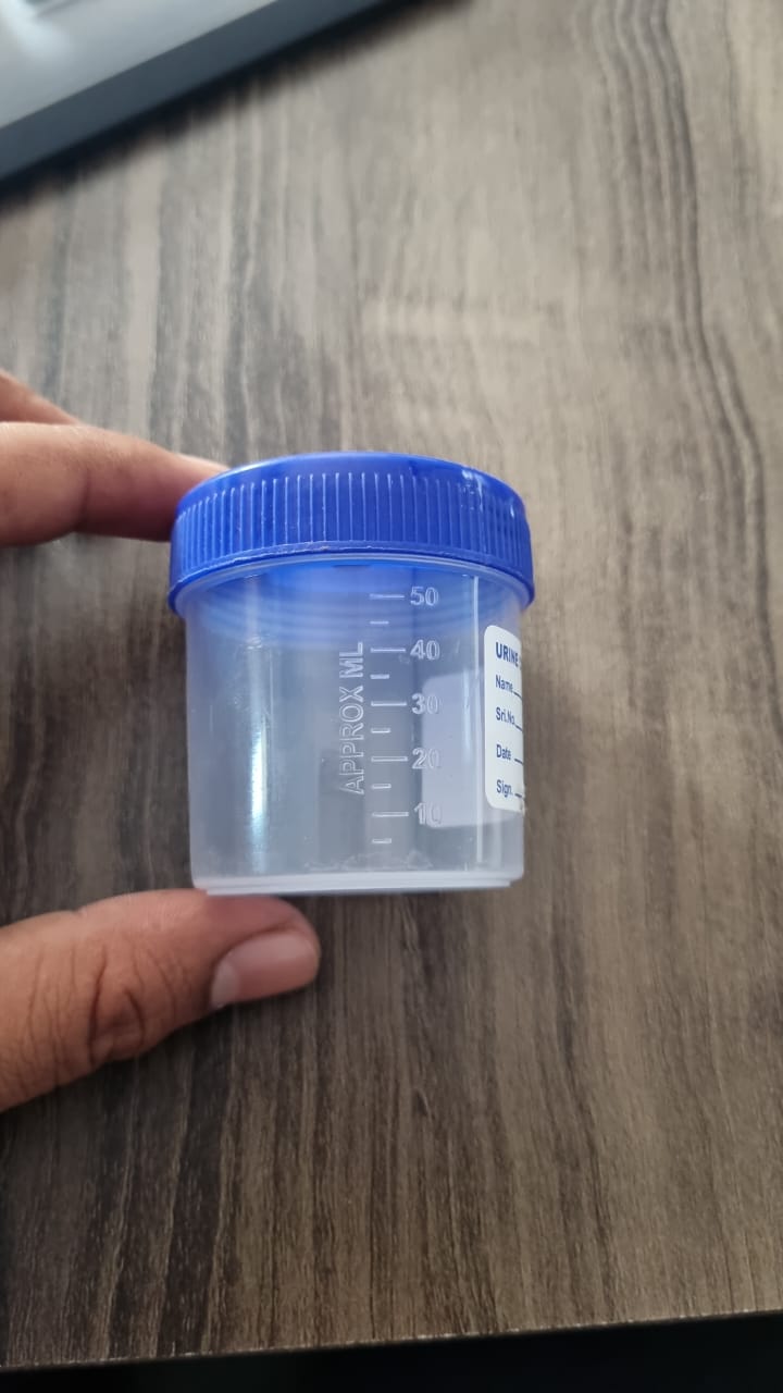 50ml Non Sterile Urine Container - Color: Transparent