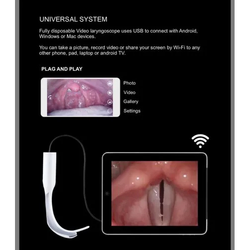 Flexible Video Laryngioscope - Usage: Hospital