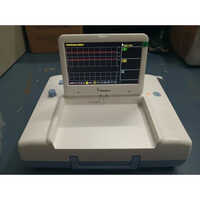 बिस्तोस फेटल मॉनिटर