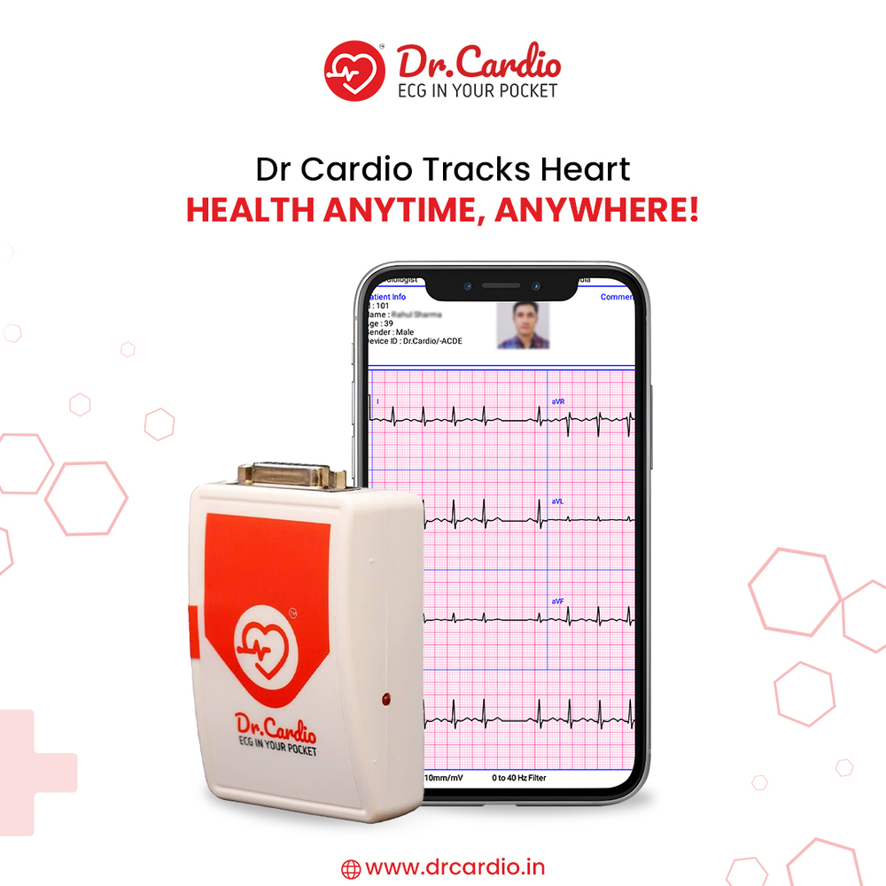 Mobile ECG Machine