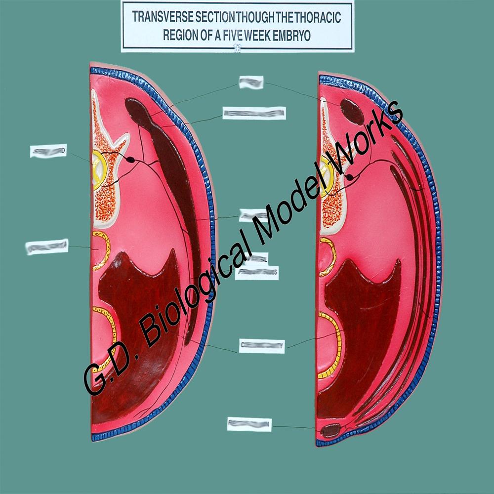 Transverse Section Through the Thoracic Region of a Five Week Embryo Model