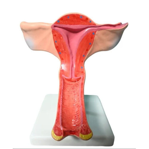 Uterus On Stand Model