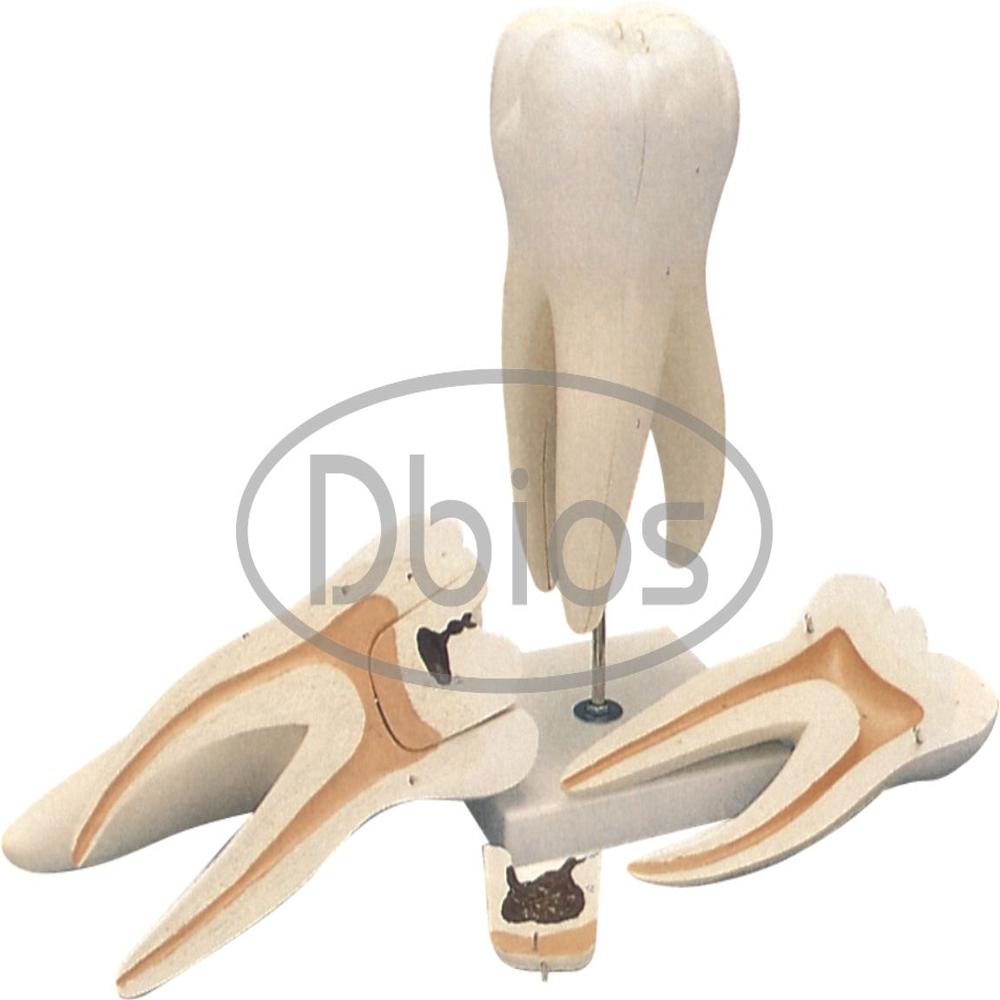 Dental tooth model