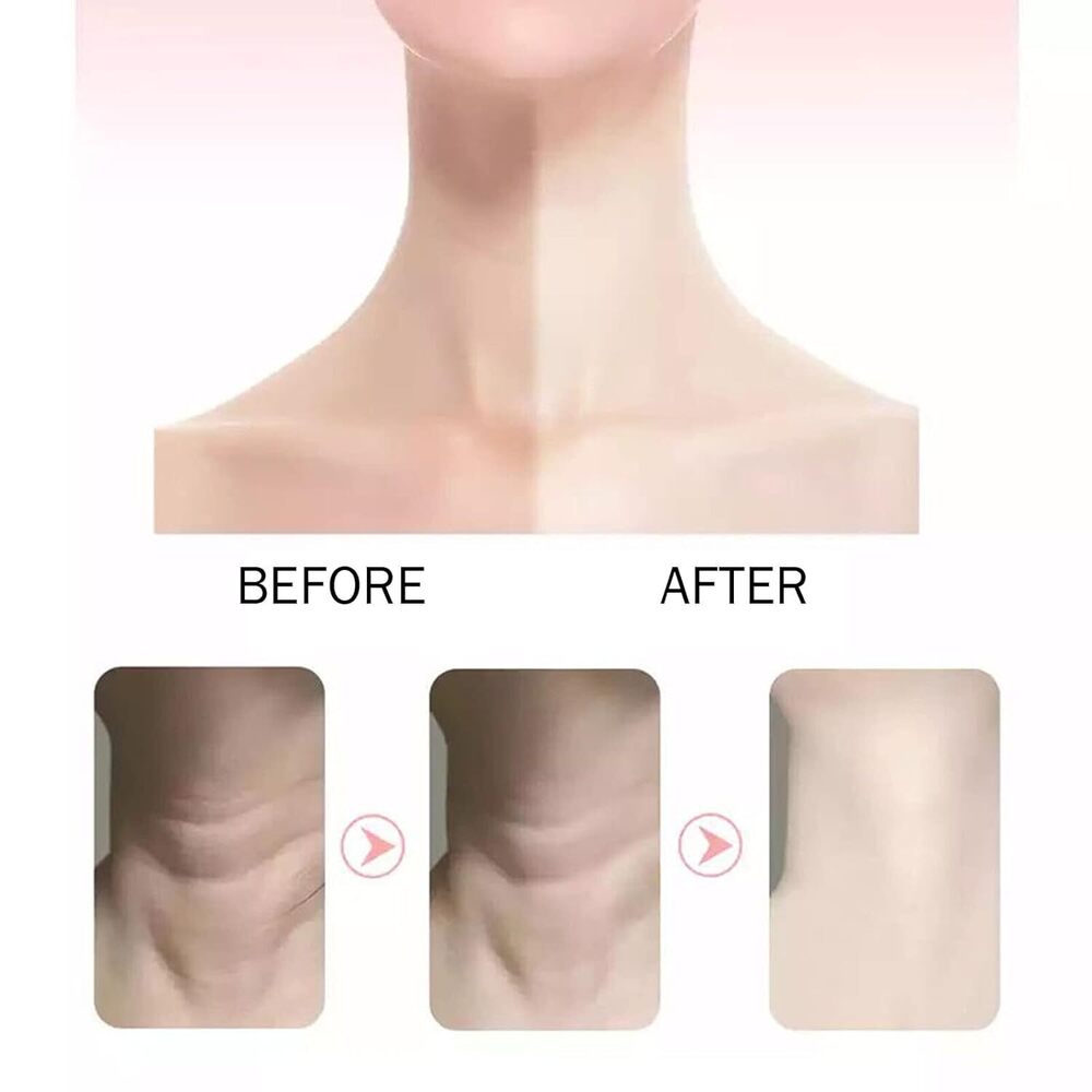 Neck Face Firming Wrinkle Removal Tool