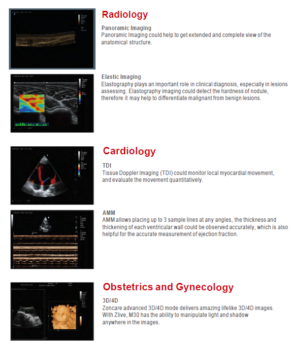 Portable ultrasound machine M30