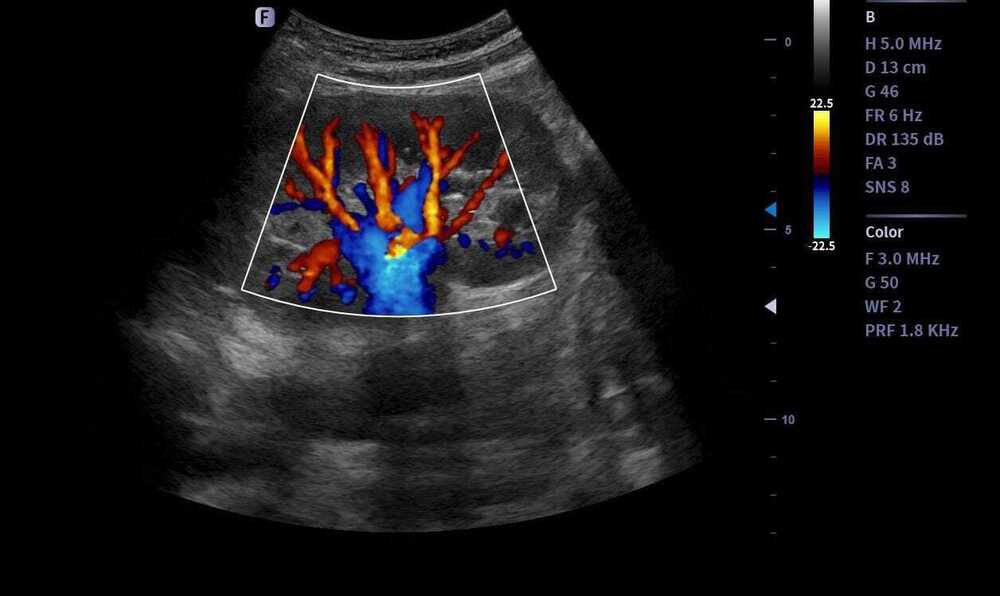 Portable ultrasound machine M30