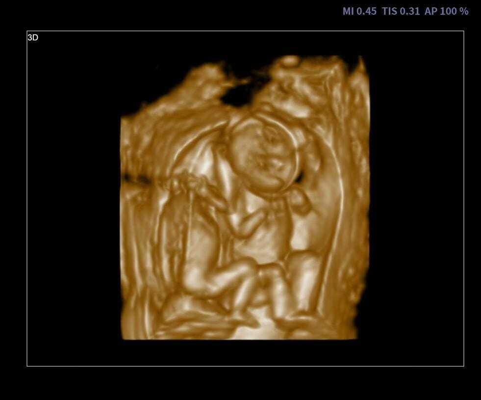 Portable ultrasound machine M30