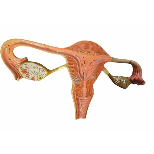 Female Healthy Uterus Model - Color: Brown