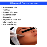 Hydra Facial Derma Brasion And Dandruff Removal 5 in1 Machine