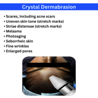 Hydra Facial Derma Brasion And Dandruff Removal 5 in1 Machine