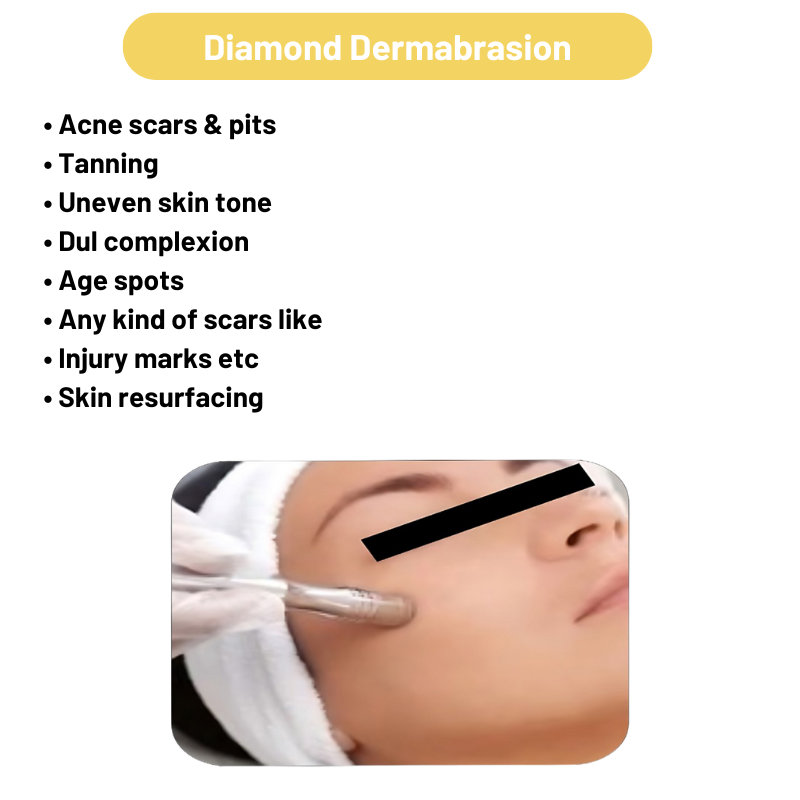 Micro derma Brasion 4 in 1 Machine