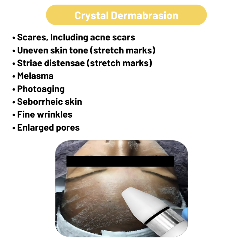 Micro derma Brasion 4 in 1 Machine