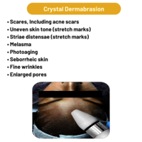 Micro derma Brasion 4 in 1 Machine