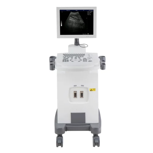 Sms Black White Ultrasound Machine - Material: Metal
