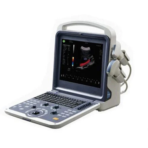 Portable Color Doppler Ultrasound Diagnostic System - Material: Metal