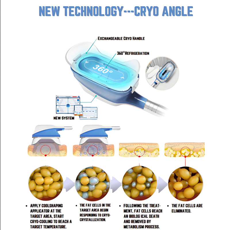 360 Cryolipolysis - Color: Blue