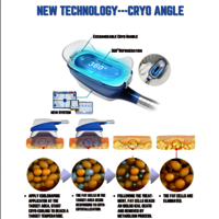 360 cryolipolysis