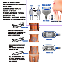 360 cryolipolysis