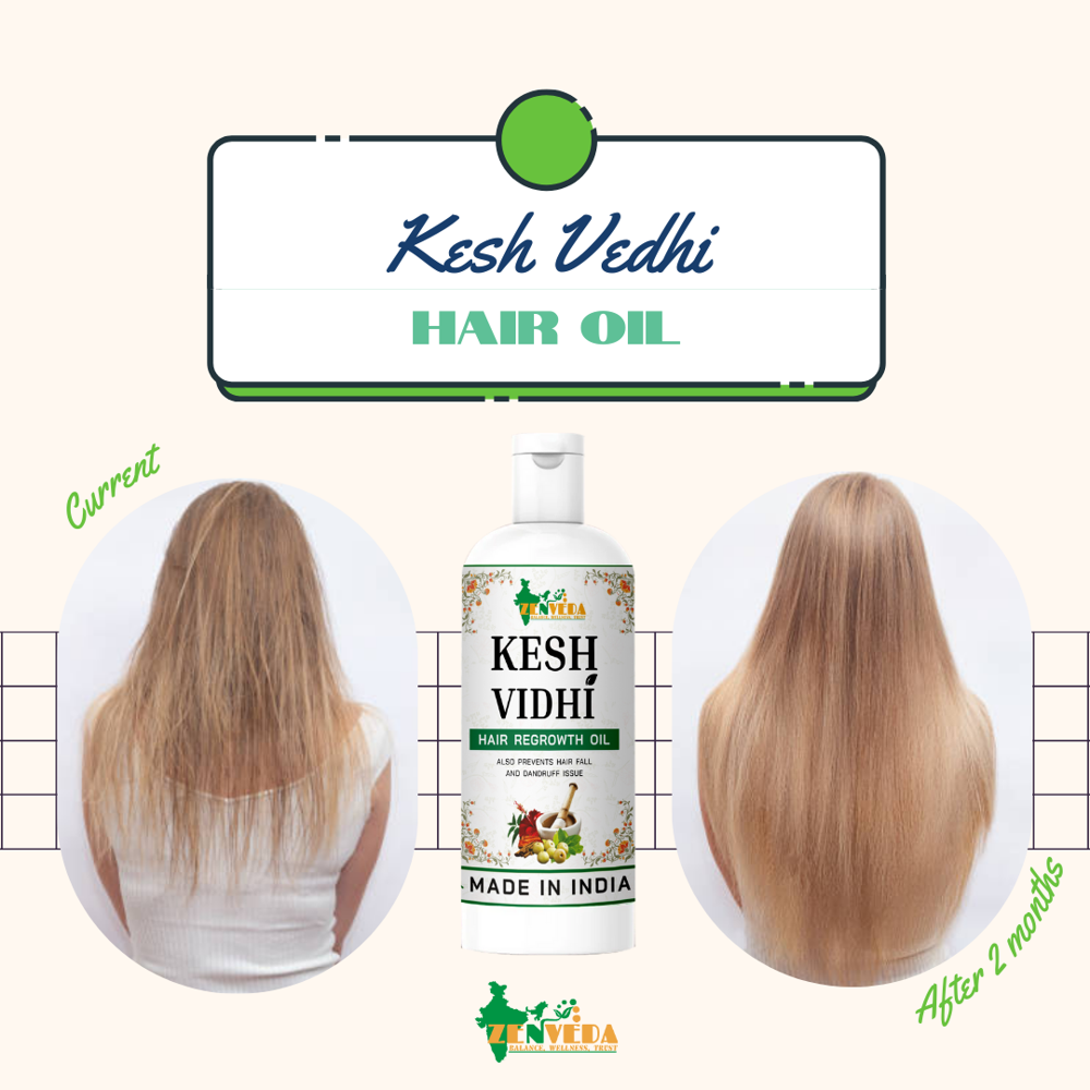50ml Kesh Vidhi Herbal Regrowth Hair Oil