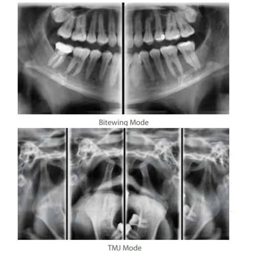 Opg Machine Panoramic X Ray - Color: Silver