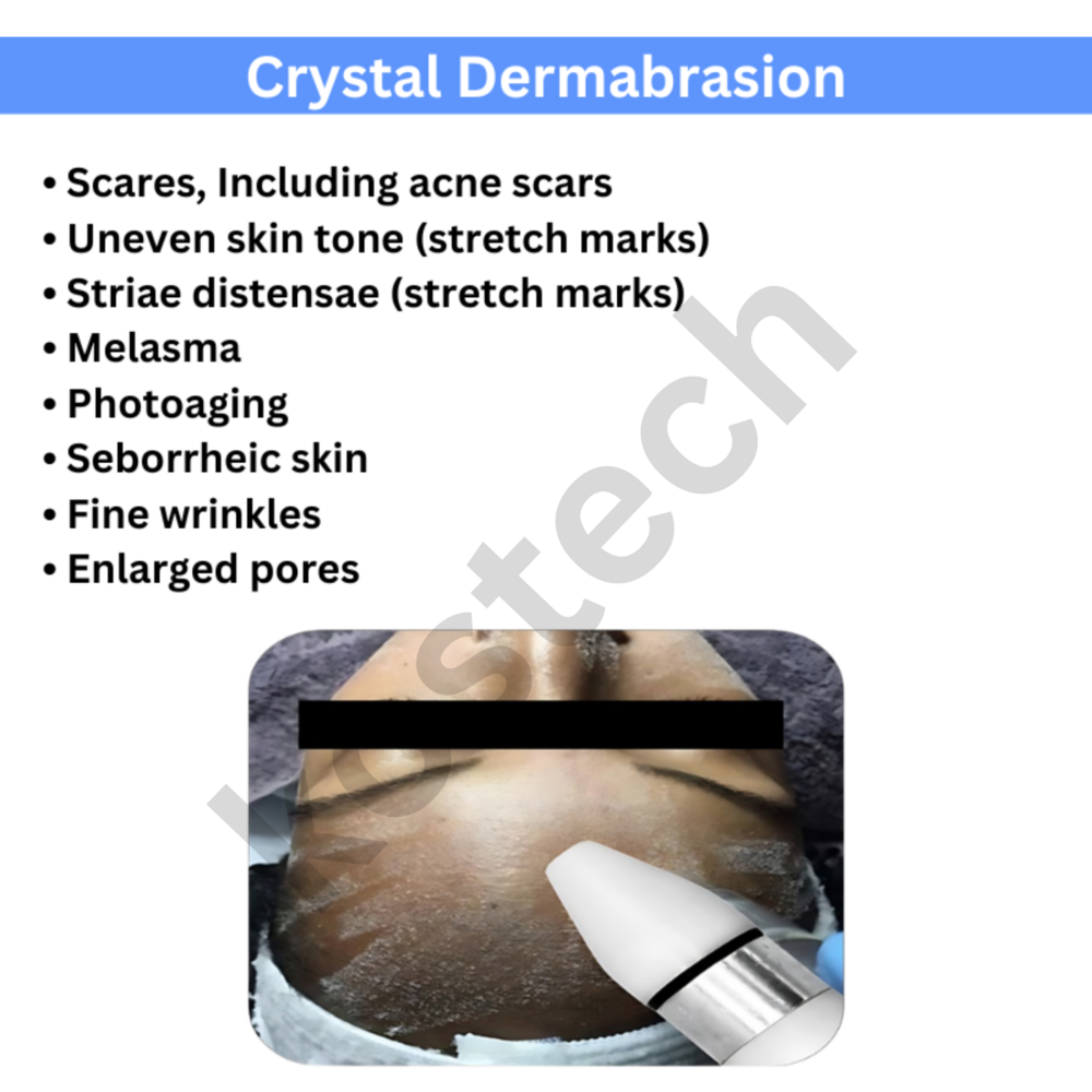 Hydra Facial Derma Brasion And Dandruff Removal 5 in1 Machine