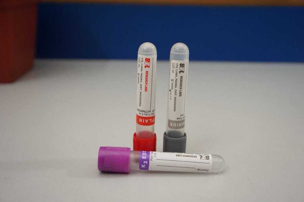 Hospital Blood Collection Tube - Color: Transparent