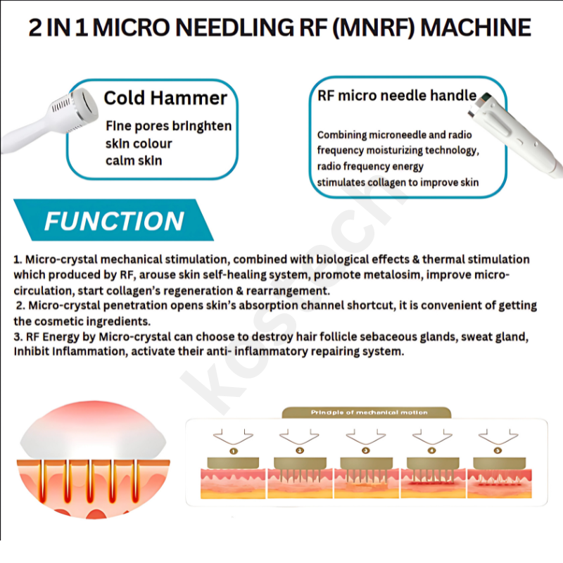 MNRF Machine