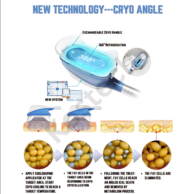 360 Cryolipolysis - Color: Blue