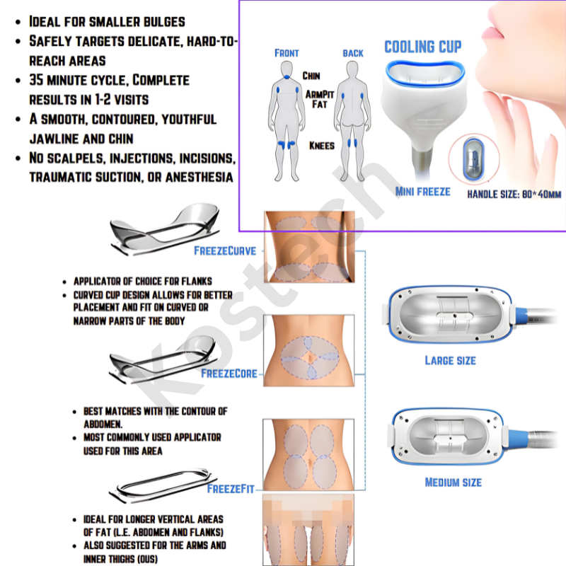 360 Cryolipolysis - Color: Blue