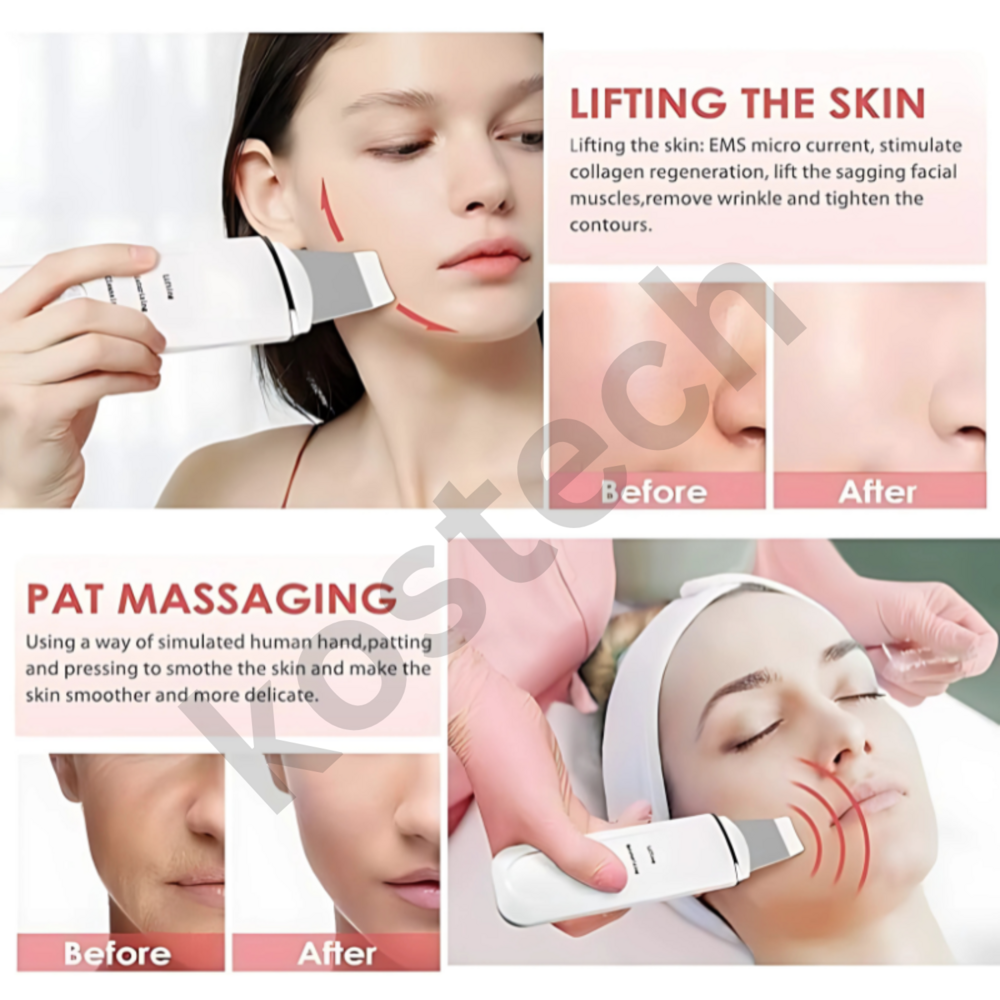 Ultrasonic Facial Scrubber