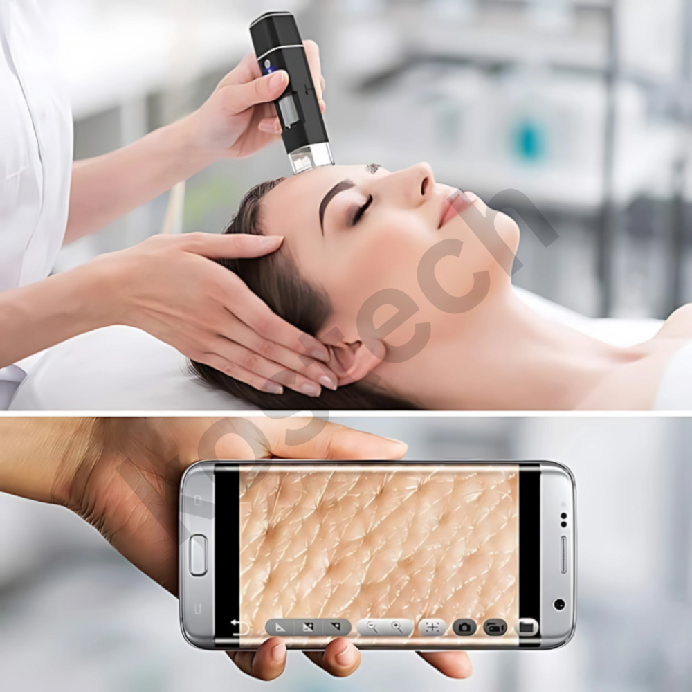 Derma Scope Wifi