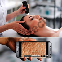 Derma Scope Wifi