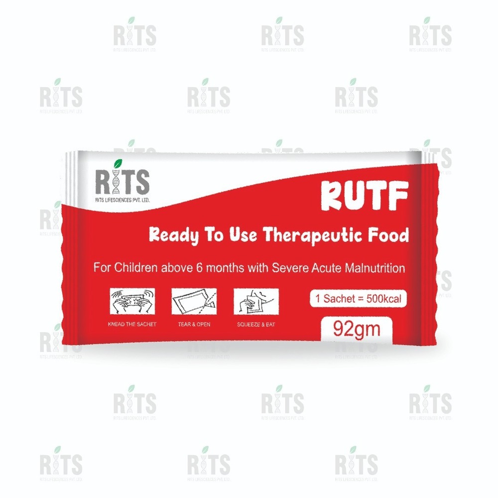 उपयोग के लिए तैयार चिकित्सीय भोजन (RUTF)