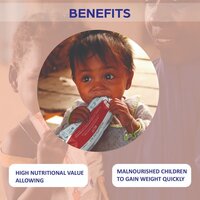 READY TO USE THERAPEUTIC FOOD (RUTF)